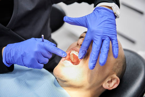 Best Emergency Dentist for Lost Fillings or Crowns in Lmer Heights, PA